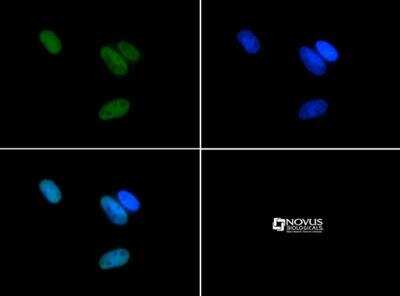 Immunocytochemistry/ Immunofluorescence: Histone H3 [Asym-dimethyl Arg17] Antibody - BSA Free [NB21-1132]